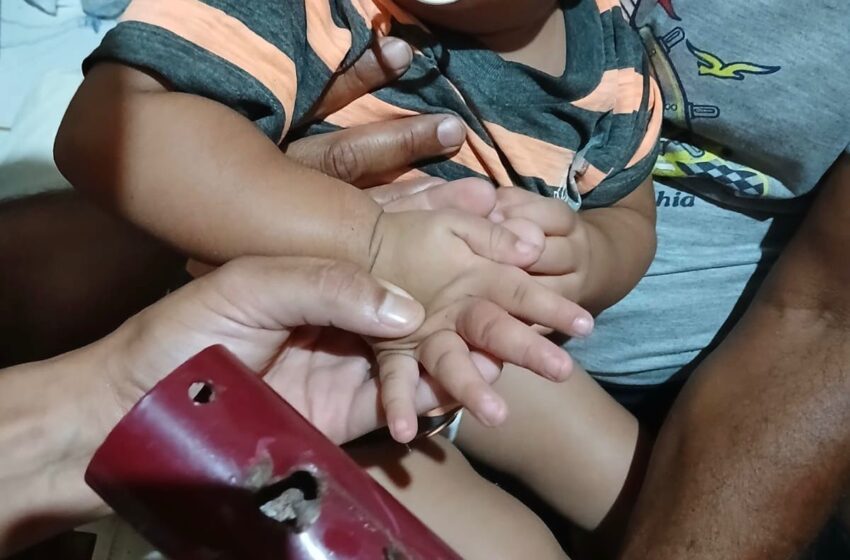  Bombeiros do 17º BBM resgatam criança com mão presa em cama em Barreiras